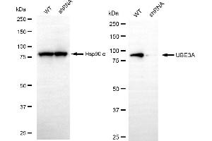 Western blotting analysis using UBE3A antibody (ABIN7800722).