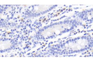 Detection of CTLA4 in Human Small intestine Tissue using Monoclonal Antibody to Cytotoxic T-Lymphocyte Associated Antigen 4 (CTLA4) (CTLA4 Antikörper  (AA 52-211))