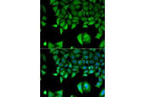 Immunofluorescence analysis of A549 cells using IL17F antibody. (IL17F Antikörper)