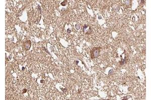 ABIN6267615 at 1/100 staining human brain tissue sections by IHC-P. (GRIN1/NMDAR1 Antikörper  (pSer890))