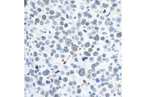 Immunohistochemistry (IHC) image for anti-Zinc Finger E-Box Binding Homeobox 1 (ZEB1) (AA 1074-1124) antibody (ABIN7454797) (ZEB1 Antikörper  (AA 1074-1124))
