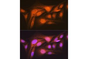 Immunofluorescence (IF) image for anti-Ribosomal Protein S6 Kinase, 70kDa, Polypeptide 2 (RPS6KB2) antibody (ABIN7270034)