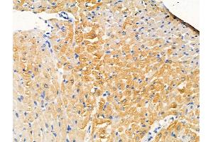 Phospho-MSP/MST1 (Thr367) Antibody at 1/100 staining Rat heart tissue by IHC-P. (MST1 Antikörper  (pThr367))