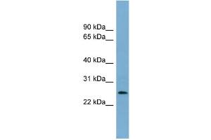 WB Suggested Anti-LIN37 Antibody Titration: 0. (LIN37 Antikörper  (Middle Region))