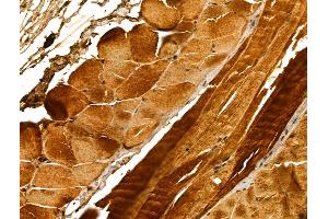 ABIN6261625 and ABIN6273045 at 1/100 staining Mouse skin tissue by IHC-P.