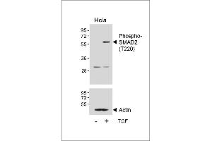 Western blot analysis of lysates from Hela cell line, untreated or treated with TGF-β, 100 ng/mL, 30 min, using Phospho-SD2 Antibody (ABIN650816 and ABIN2839794) (upper) or Beta-actin (lower). (SMAD2 Antikörper  (pThr220))