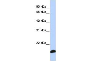 WB Suggested Anti-PRDX5 Antibody Titration: 0. (Peroxiredoxin 5 Antikörper  (Middle Region))