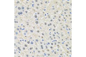 Immunohistochemistry of paraffin-embedded mouse liver using SLC3A2 antibody. (SLC3A2 Antikörper)