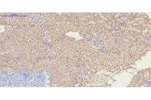 Immunohistochemistry of paraffin-embedded Rat kidney tissue using CD23 Monoclonal Antibody at dilution of 1:200. (FCER2 Antikörper)