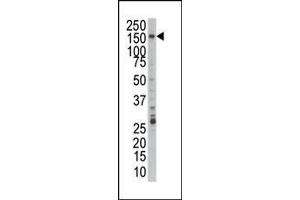 Western blot analysis of anti-PRP4 Pab in Jurkat cell lysate. (PRPF4B Antikörper  (C-Term))