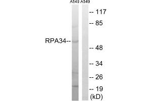 Western blot analysis of extracts from A549 cells, using CD3EAP antibody. (CD3EAP Antikörper  (C-Term))