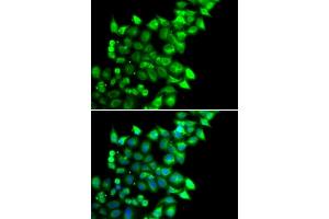 Immunofluorescence analysis of U2OS cells using MEST antibody (ABIN6133292, ABIN6143749, ABIN6143751 and ABIN6222673). (MEST Antikörper  (AA 146-335))
