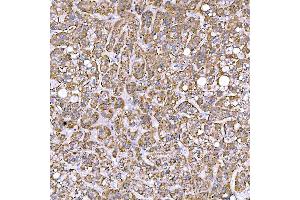 IHC analysis of STAP2 using anti-STAP2 antibody (ABIN7602686). (STAP2 Antikörper  (AA 95-392))