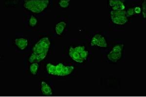 Immunofluorescent analysis of PC-3 cells using ABIN7169055 at dilution of 1:100 and Alexa Fluor 488-congugated AffiniPure Goat Anti-Rabbit IgG(H+L) (UHMK1 Antikörper  (AA 183-385))