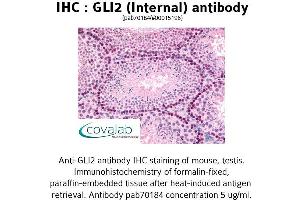Image no. 1 for anti-GLI Family Zinc Finger 2 (GLI2) (Internal Region) antibody (ABIN1734718) (GLI2 Antikörper  (Internal Region))