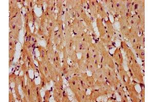 Immunohistochemistry (IHC) image for anti-Protein Tyrosine Phosphatase Receptor Type K (PTPRK) (AA 589-749) antibody (ABIN7167509)