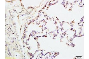Formalin-fixed and rat lung tissue labeled with Anti-IQGAP1 Polyclonal Antibody, Unconjugated  at 1:200 followed by conjugation to the secondary antibody and DAB staining (IQGAP1 Antikörper  (AA 1451-1550))