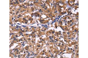 Immunohistochemistry (IHC) image for anti-Selectin P Ligand (SELPLG) antibody (ABIN2422074) (SELPLG Antikörper)