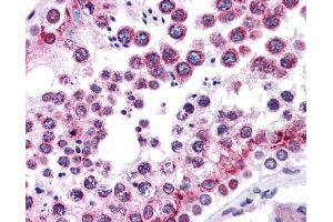 Immunohistochemistry (IHC) image for anti-Wingless-Type MMTV Integration Site Family, Member 5B (WNT5B) (Middle Region) antibody (ABIN2776725) (WNT5B Antikörper  (Middle Region))