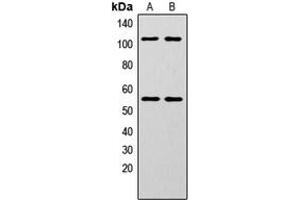 Western blot analysis of NF-kappaB p105/p50 (pS337) expression in HeLa (A), MCF7 (B) whole cell lysates. (NFKB1 Antikörper  (pSer337))