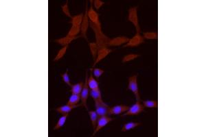 Immunofluorescence (IF) image for anti-Bone Morphogenetic Protein 4 (BMP4) (AA 1-408) antibody (ABIN6137600)