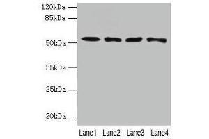Western blot All lanes: CAP2 antibody at 4 μg/mL Lane 1: HepG2 whole cell lysate Lane 2: Mouse muscle tissue Lane 3: Mouse gonadal tissue Lane 4: Hela whole cell lysate Secondary Goat polyclonal to rabbit IgG at 1/10000 dilution Predicted band size: 53, 46, 25 kDa Observed band size: 53 kDa (CAP2 Antikörper  (AA 221-477))