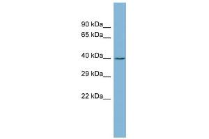 WB Suggested Anti-ZCCHC12 Antibody Titration: 0. (ZCCHC12 Antikörper  (Middle Region))