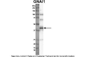 Sample Type: Nthy-ori cell lysate (50ug)Primary Dilution: 1:1000Secondary Antibody: anti-rabbit HRPSecondary Dilution: 1:2000Image Submitted By: Anonymous (GNAI1 Antikörper  (Middle Region))