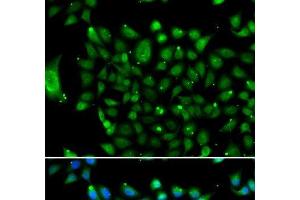 Immunofluorescence analysis of U2OS cells using NCOR1 Polyclonal Antibody (NCOR1 Antikörper)