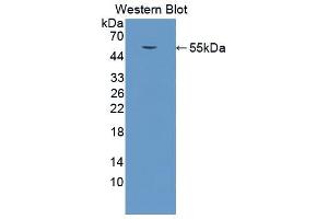 Western blot analysis of the recombinant protein. (Cathepsin K Antikörper  (AA 113-316))