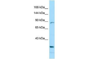 WB Suggested Anti-PRICKLE2 Antibody Titration: 1.