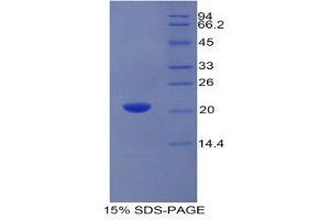 SDS-PAGE (SDS) image for Growth Arrest-Specific 6 (GAS6) (AA 356-511) protein (His tag) (ABIN1980689) (GAS6 Protein (AA 356-511) (His tag))