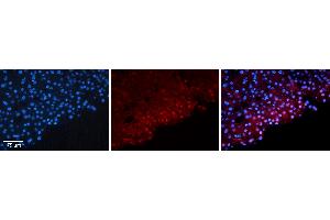 Rabbit Anti-FOSB Antibody   Formalin Fixed Paraffin Embedded Tissue: Human Liver Tissue Observed Staining: Nucleus in hepatocytes Primary Antibody Concentration: 1:100 Other Working Concentrations: N/A Secondary Antibody: Donkey anti-Rabbit-Cy3 Secondary Antibody Concentration: 1:200 Magnification: 20X Exposure Time: 0. (FOSB Antikörper  (N-Term))
