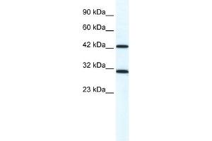 DDX39 antibody used at 1. (DDX39 Antikörper)
