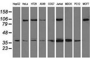 Western blot analysis of extracts (35 µg) from 9 different cell lines by using anti-XRCC1 monoclonal antibody. (XRCC1 Antikörper)