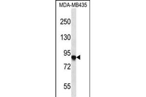 AF Antibody (C-term) 2749b western blot analysis in MDA-M cell line lysates (35 μg/lane). (AFAP Antikörper  (C-Term))