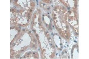 DAB staining on IHC-P; Samples: Human Kidney Tissue. (UCP2 Antikörper  (AA 154-289))