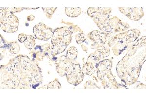 Immunohistochemistry (IHC) image for anti-Heparanase (HPSE) (AA 34-115) antibody (ABIN7438010)