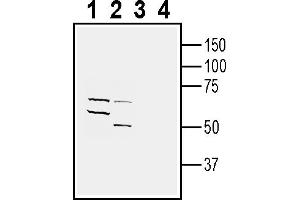 anti-Serotonin Receptor 6 (HTR6) (AA 167-181), (Extracellular) antibody