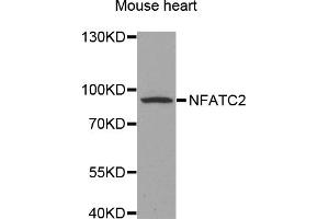 Western blot analysis of extracts of mouse heart, using NFATC2 antibody (ABIN5971589) at 1/500 dilution. (NFAT1 Antikörper)