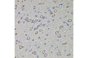 Immunohistochemistry of paraffin-embedded rat brain using PTCD3 antibody. (PTCD3 Antikörper  (AA 450-689))