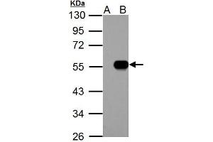 WB Image IP6K1 antibody detects IP6K1 protein by western blot analysis. (IP6K1 Antikörper)