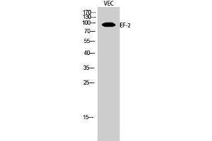 Western Blotting (WB) image for anti-Eukaryotic Translation Elongation Factor 2 (EEF2) (Ser311) antibody (ABIN3184410) (EEF2 Antikörper  (Ser311))