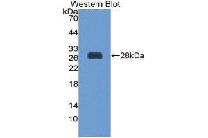 Western Blotting (WB) image for anti-Suppressor of Cytokine Signaling 3 (SOCS3) (AA 1-225) antibody (ABIN1860596) (SOCS3 Antikörper  (AA 1-225))
