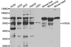 Western Blotting (WB) image for anti-Serotonin Receptor 2B (HTR2B) antibody (ABIN1876871) (Serotonin Receptor 2B Antikörper)