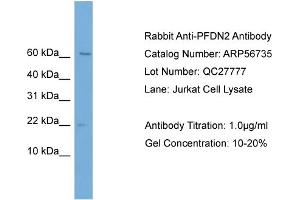 Western Blotting (WB) image for anti-Prefoldin Subunit 2 (PFDN2) (Middle Region) antibody (ABIN2786872)