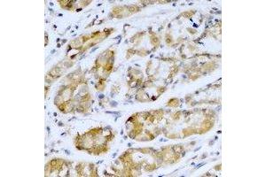 Immunohistochemical analysis of SETD5 staining in human stomach formalin fixed paraffin embedded tissue section. (SETD5 Antikörper)