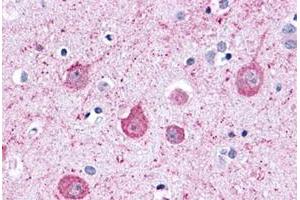 Immunohistochemical staining of human brain, neurons and glia with LPHN2 polyclonal antibody . (LPHN2 Antikörper  (C-Term))