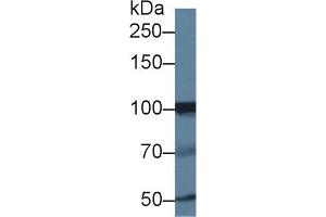 Western blot analysis of Human Jurkat cell lysate, using Human INPP4A Antibody (1 µg/ml) and HRP-conjugated Goat Anti-Rabbit antibody ( (INPP4A Antikörper  (AA 1-137))