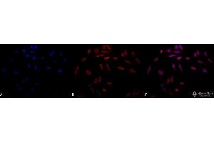Immunocytochemistry/Immunofluorescence analysis using Mouse Anti-Hsp47 Monoclonal Antibody, Clone 1C4-1A6 . (SERPINH1 Antikörper  (Atto 390))